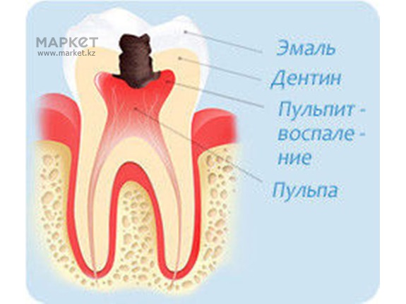 Лазерная эпиляция в Петропавловске