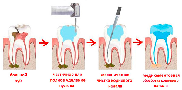 Лазерная эпиляция в Петропавловске
